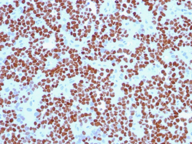 NKX2.2 (Neuroendocrine and Ewing's Sarcoma Marker) Antibody in Immunohistochemistry (Paraffin) (IHC (P))