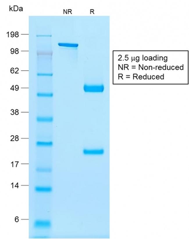 NKX2.2 Antibody in SDS-PAGE (SDS-PAGE)