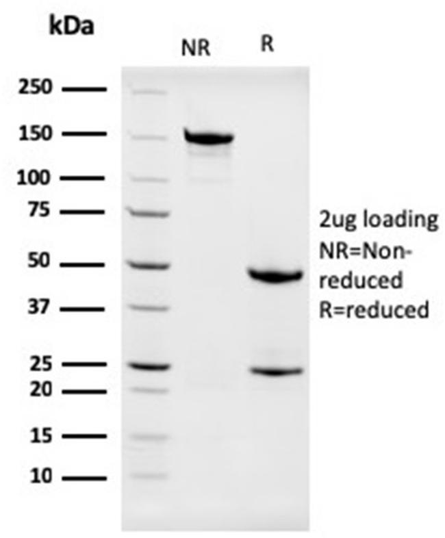 Nucleophosmin Antibody in SDS-PAGE (SDS-PAGE)