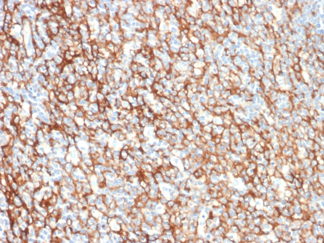 CD73 (Immuno-Oncology Target) Antibody in Immunohistochemistry (Paraffin) (IHC (P))