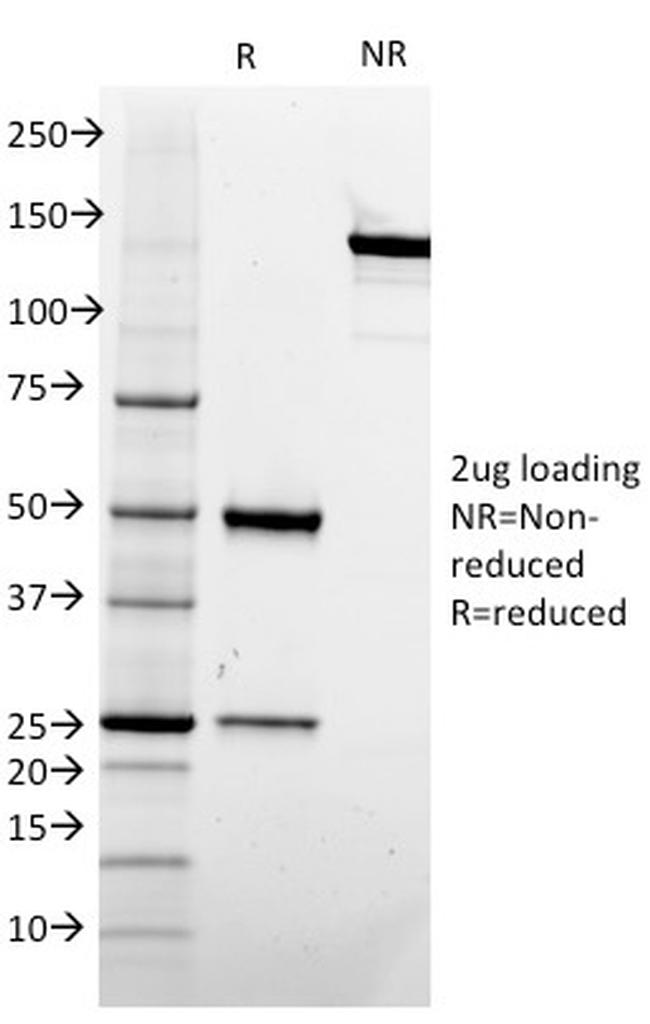 CD73 (Immuno-Oncology Target) Antibody in SDS-PAGE (SDS-PAGE)
