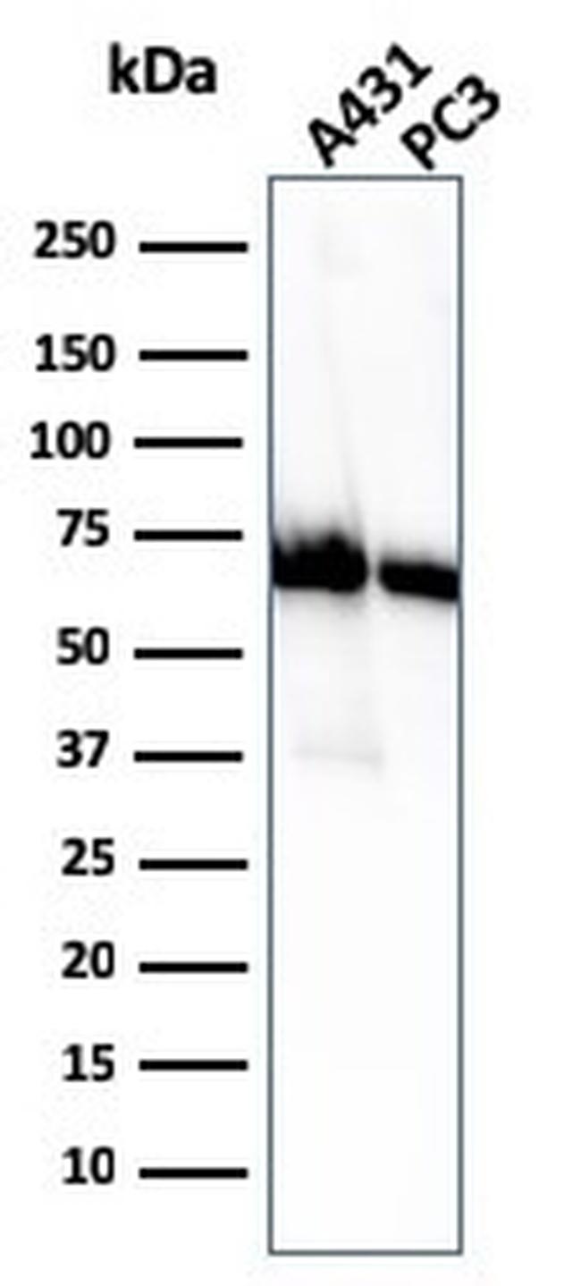 CD73 (Immuno-Oncology Target) Antibody in Western Blot (WB)
