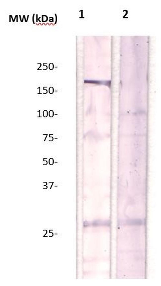Phospho-Rho Kinase/ROCKII (Thr396) Antibody in Western Blot (WB)