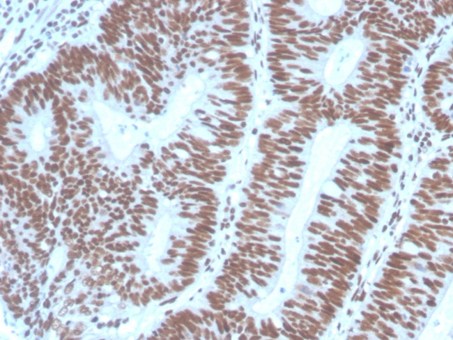 PAX2 (Renal Cell and Ovarian Carcinoma Marker) Antibody in Immunohistochemistry (Paraffin) (IHC (P))