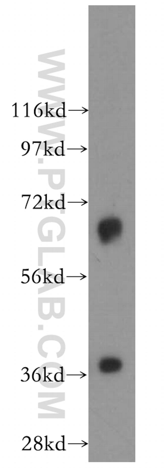 Mecr Antibody in Western Blot (WB)