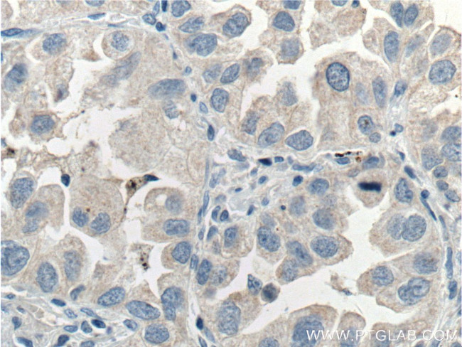SIK1 Antibody in Immunohistochemistry (Paraffin) (IHC (P))