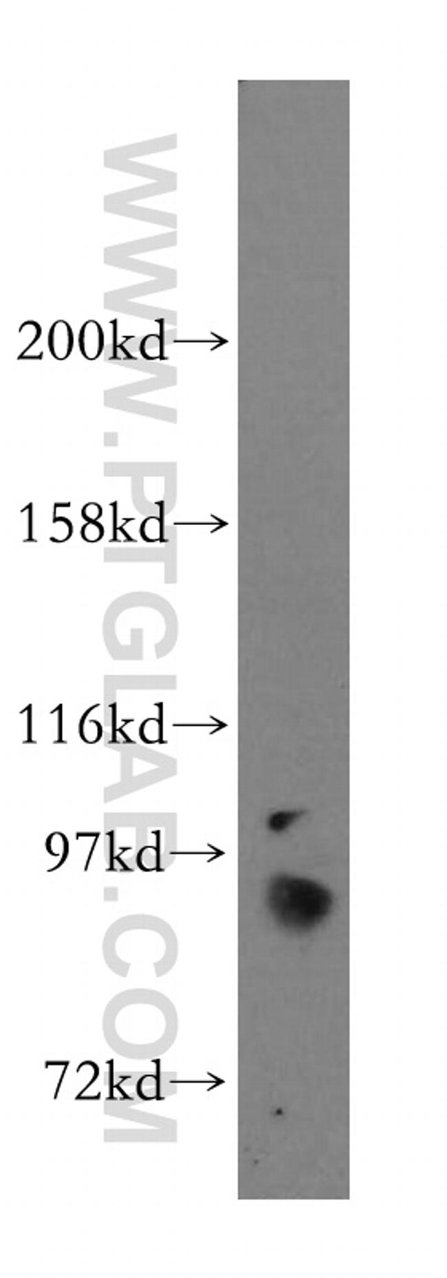 STAT5A Antibody in Western Blot (WB)