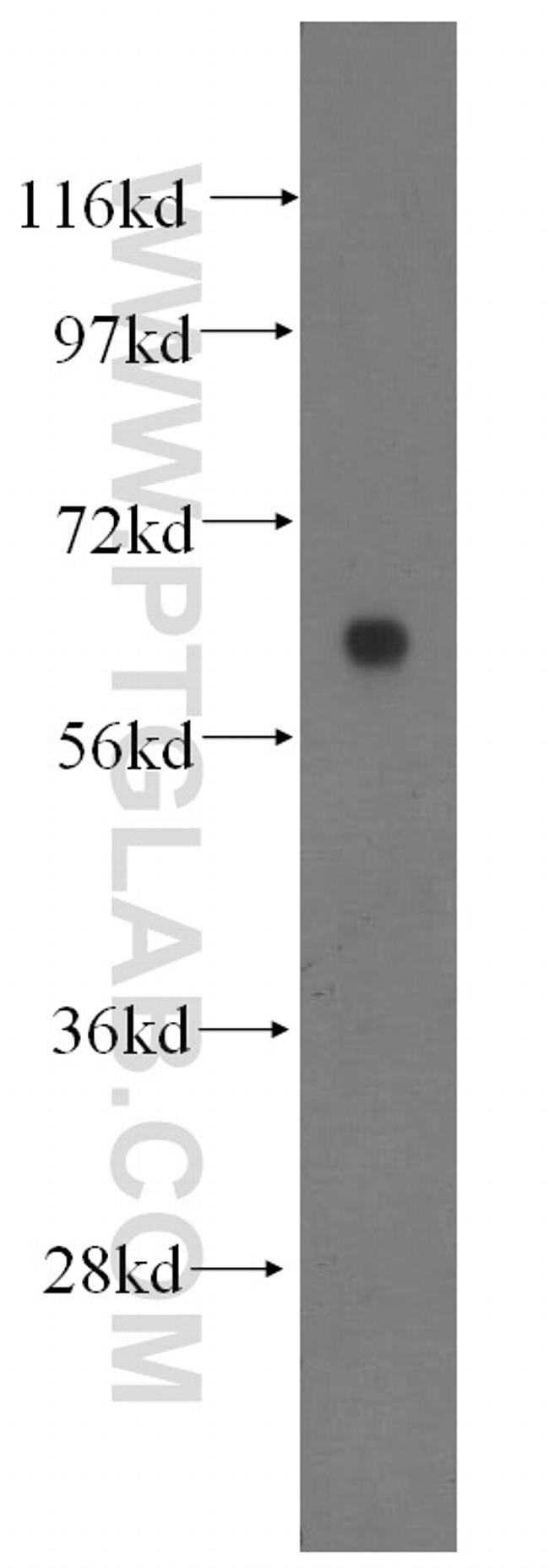 HYAL2 Antibody in Western Blot (WB)