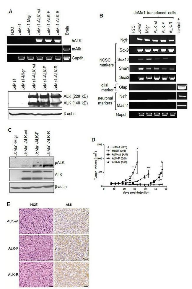 ALK Antibody in Western Blot, Immunohistochemistry (WB, IHC)