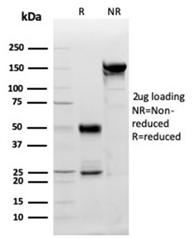 PDGF beta (PDGFB) Antibody in SDS-PAGE (SDS-PAGE)