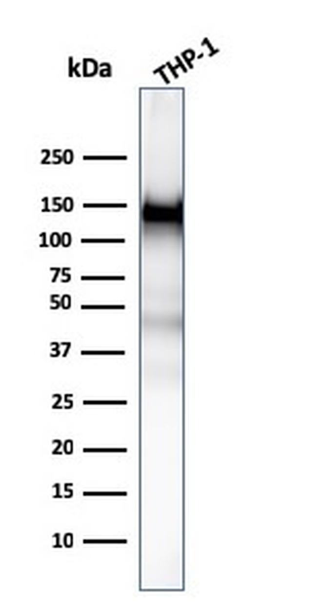 CD31/PECAM-1 Antibody in Western Blot (WB)
