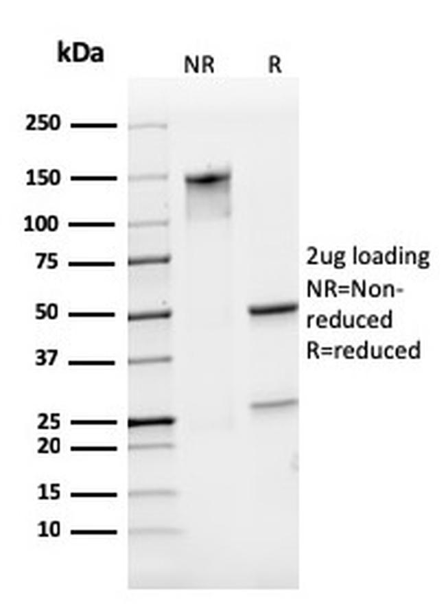 CD31/PECAM-1 Antibody in SDS-PAGE (SDS-PAGE)