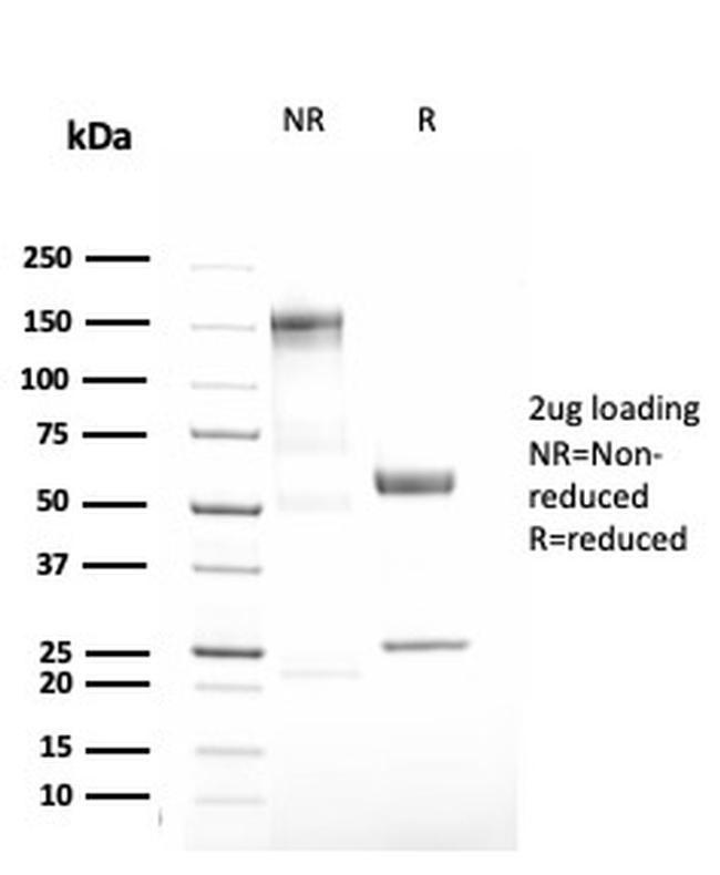 Alpha-1-Antitrypsin (SERPINA1) Antibody in SDS-PAGE (SDS-PAGE)