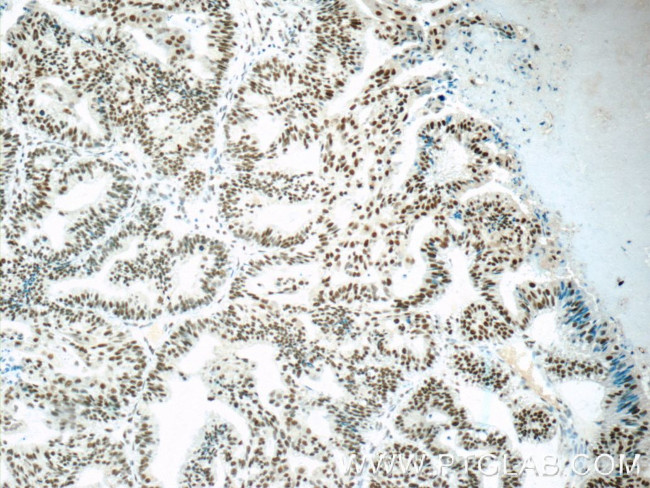 SETD1B Antibody in Immunohistochemistry (Paraffin) (IHC (P))