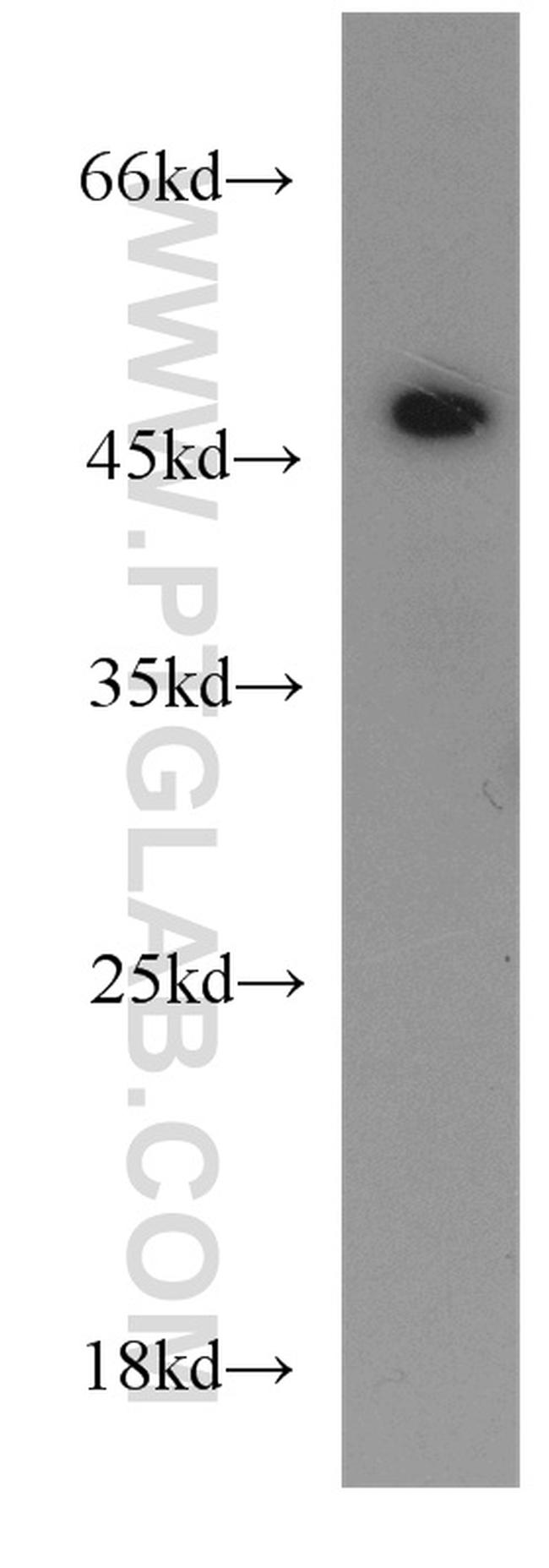Synaptotagmin-12 Antibody in Western Blot (WB)
