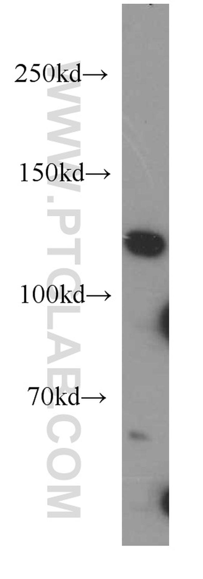XYLT1 Antibody in Western Blot (WB)