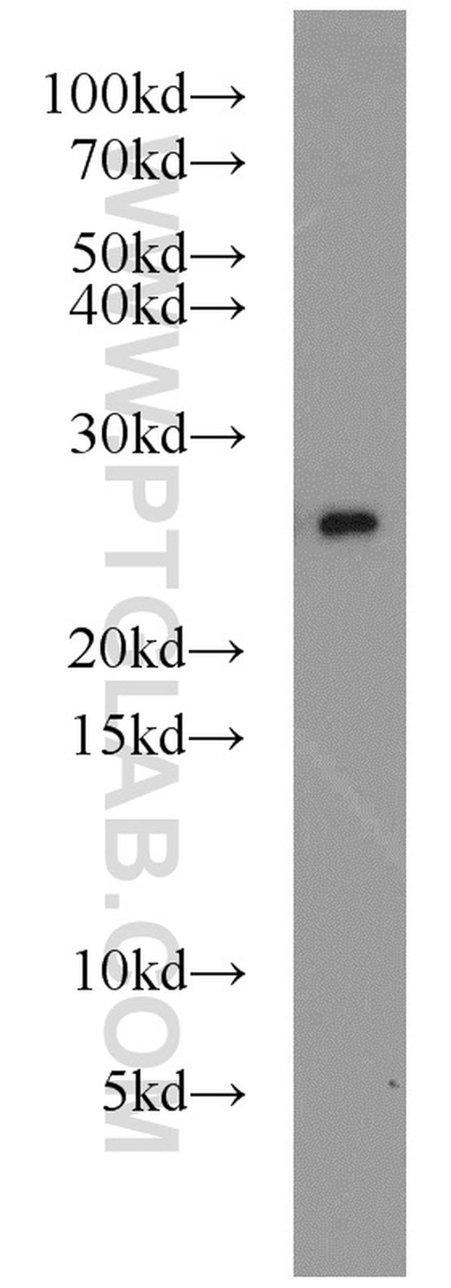 PRDX3 Antibody in Western Blot (WB)