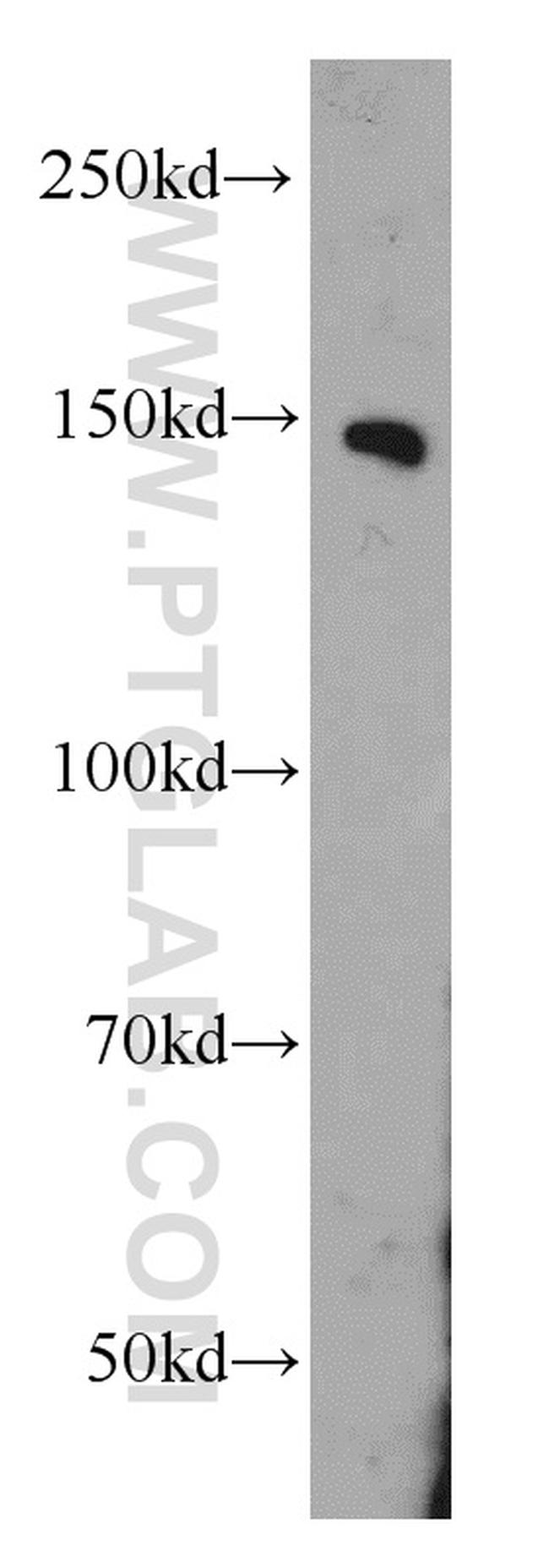 PTPRJ Antibody in Western Blot (WB)