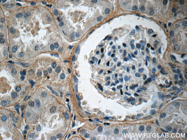 Collagen Type IV Antibody in Immunohistochemistry (Paraffin) (IHC (P))