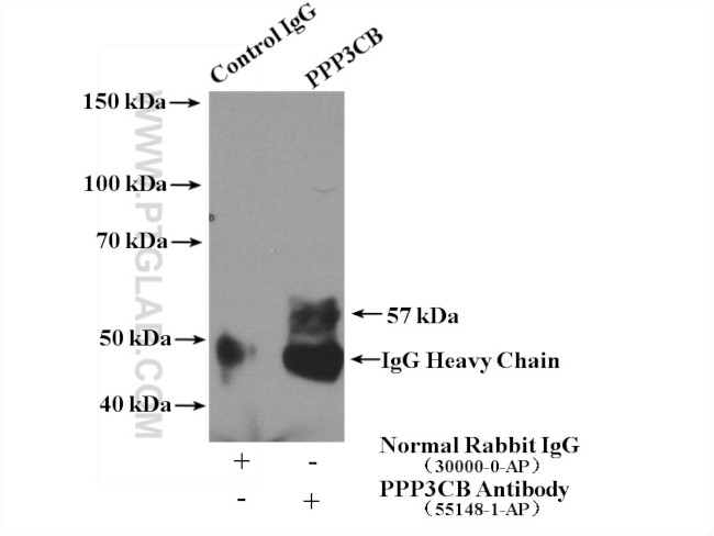 PPP3CB Antibody in Immunoprecipitation (IP)