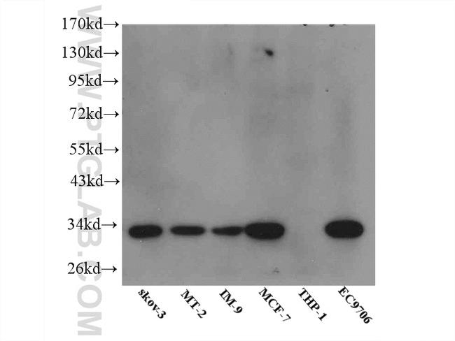 IGFBP5 Antibody in Western Blot (WB)