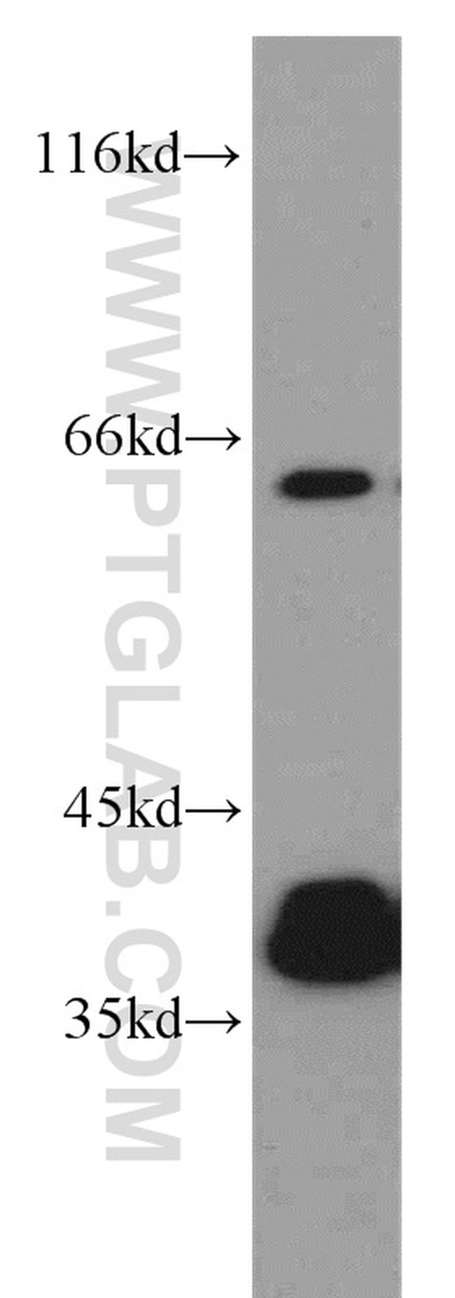 PLS3 Antibody in Western Blot (WB)