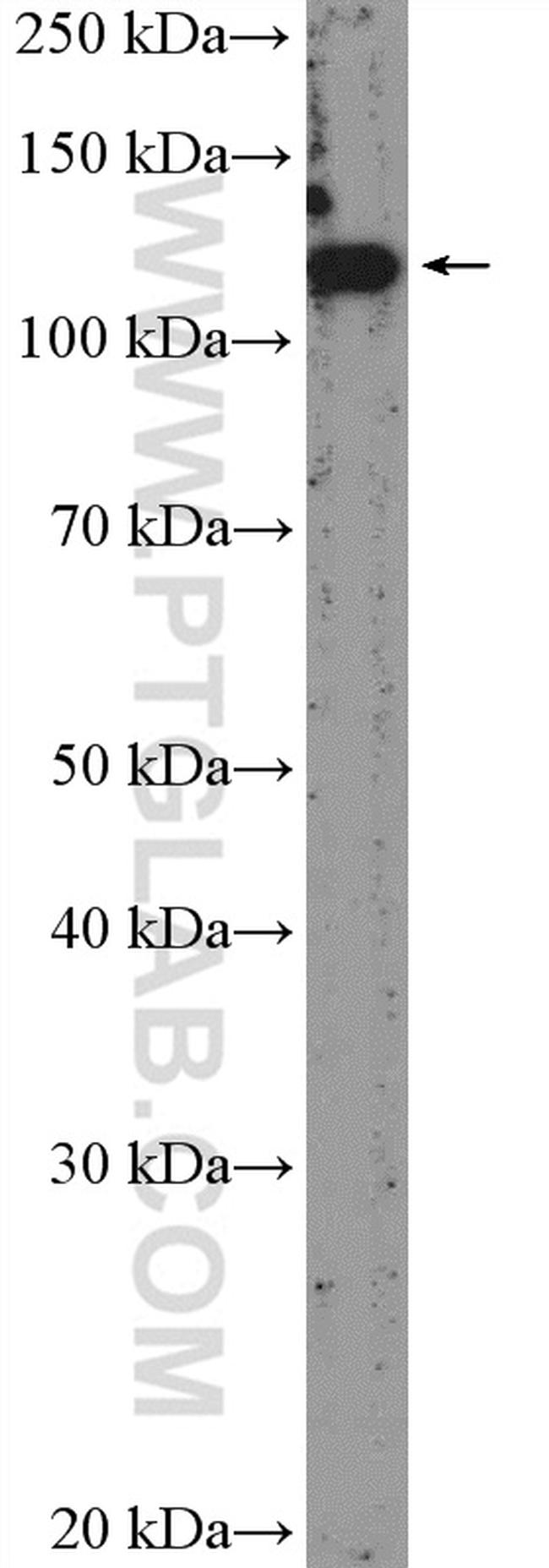 BNC2 Antibody in Western Blot (WB)