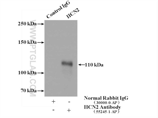 HCN2 Antibody in Immunoprecipitation (IP)