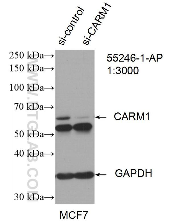 CARM1 Antibody in Western Blot (WB)