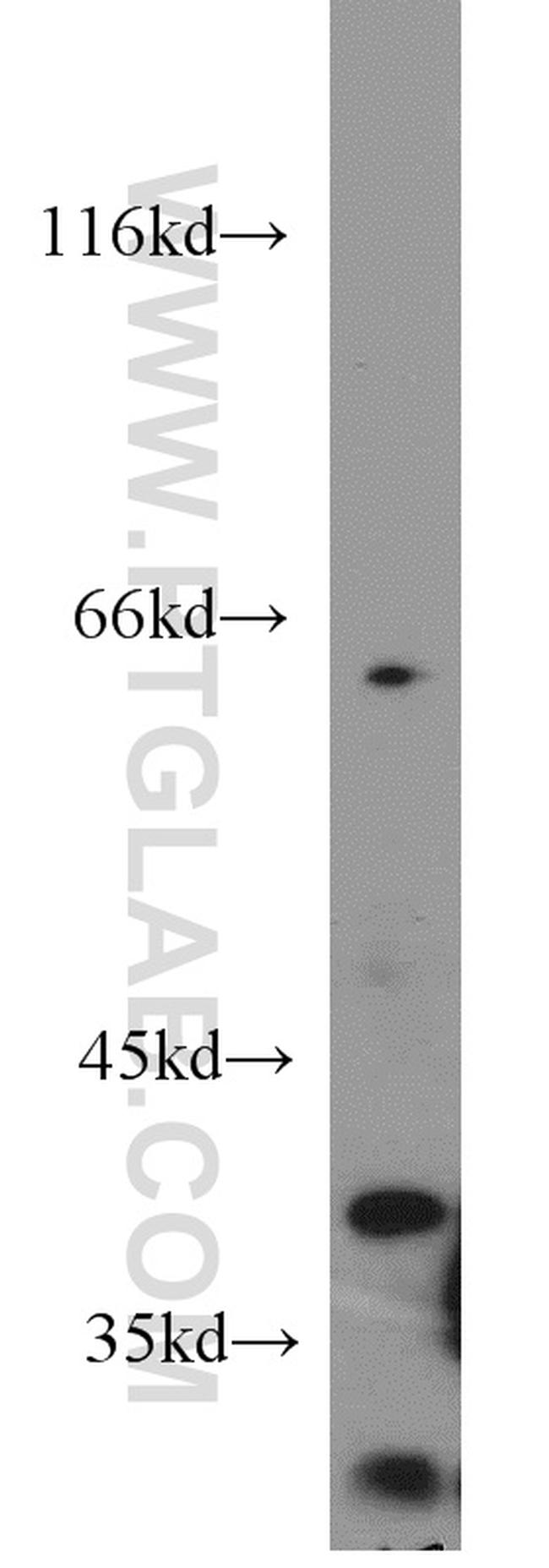 MORF4L1 Antibody in Western Blot (WB)