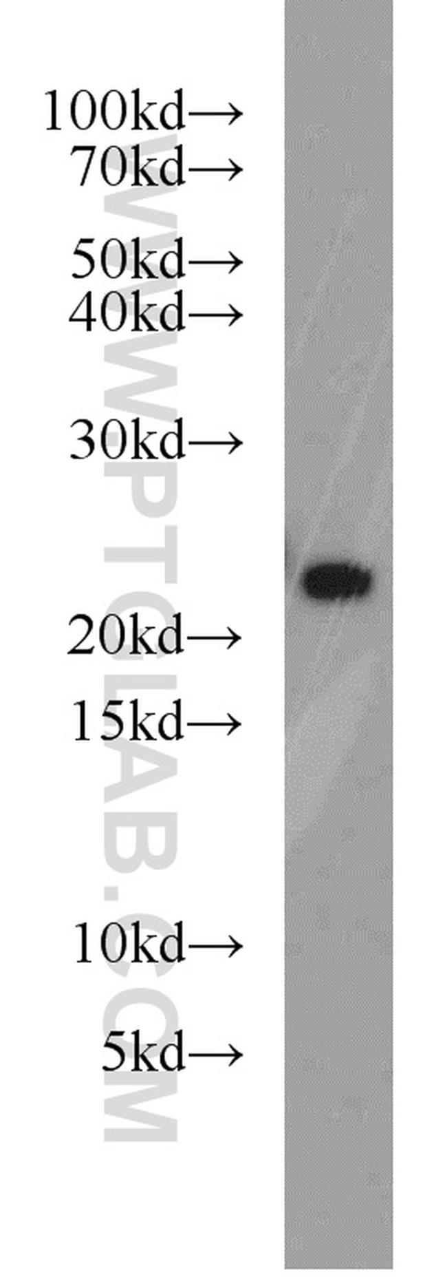 RAB8B Antibody in Western Blot (WB)