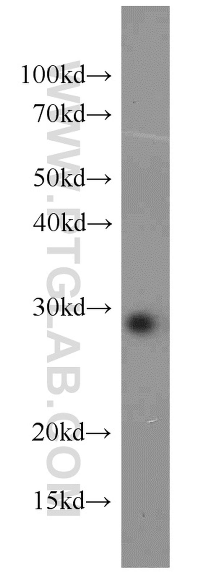 RAB8B Antibody in Western Blot (WB)