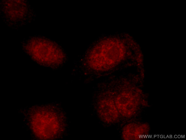 SETD2 Antibody in Immunocytochemistry (ICC/IF)