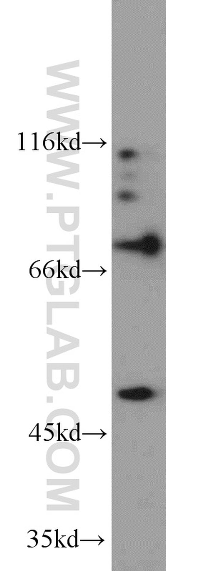 PGAP1 Antibody in Western Blot (WB)
