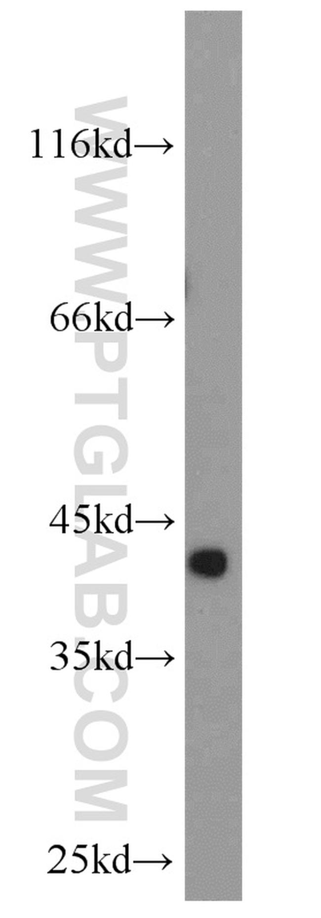 TRIM63 Antibody in Western Blot (WB)