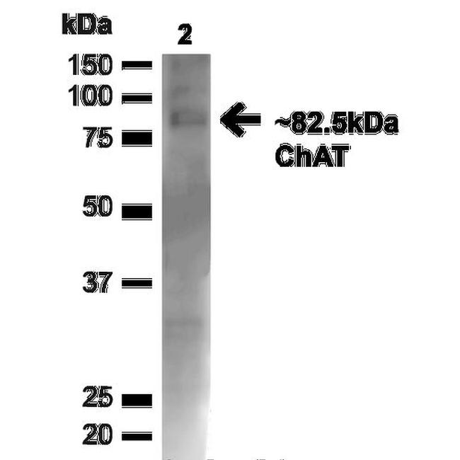 Choline acetyltransferase Antibody in Western Blot (WB)