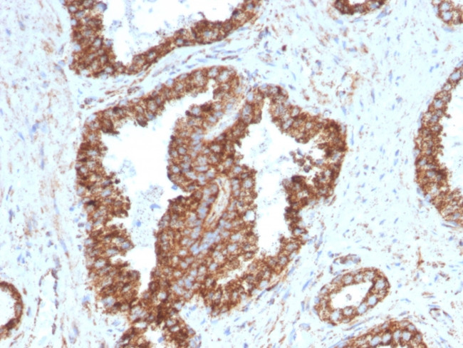 PMEPA1/TMEPAI (Tumor Suppressor Oncoprotein) Antibody in Immunohistochemistry (Paraffin) (IHC (P))