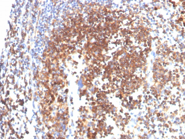 SLAMF7/CS1/CD319 Antibody in Immunohistochemistry (Paraffin) (IHC (P))