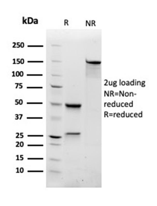 Ras-related C3 botulinum toxin substrate 1 Antibody in SDS-PAGE (SDS-PAGE)