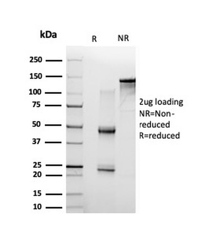NF-kB p65/RELA Antibody in SDS-PAGE (SDS-PAGE)