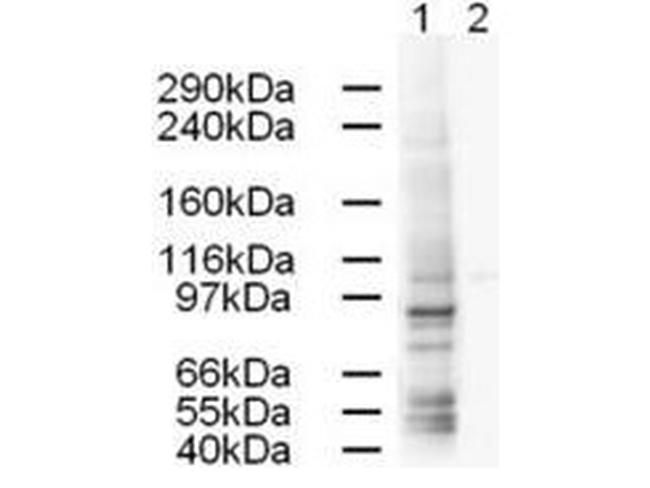 AP1G1 Antibody in Western Blot (WB)