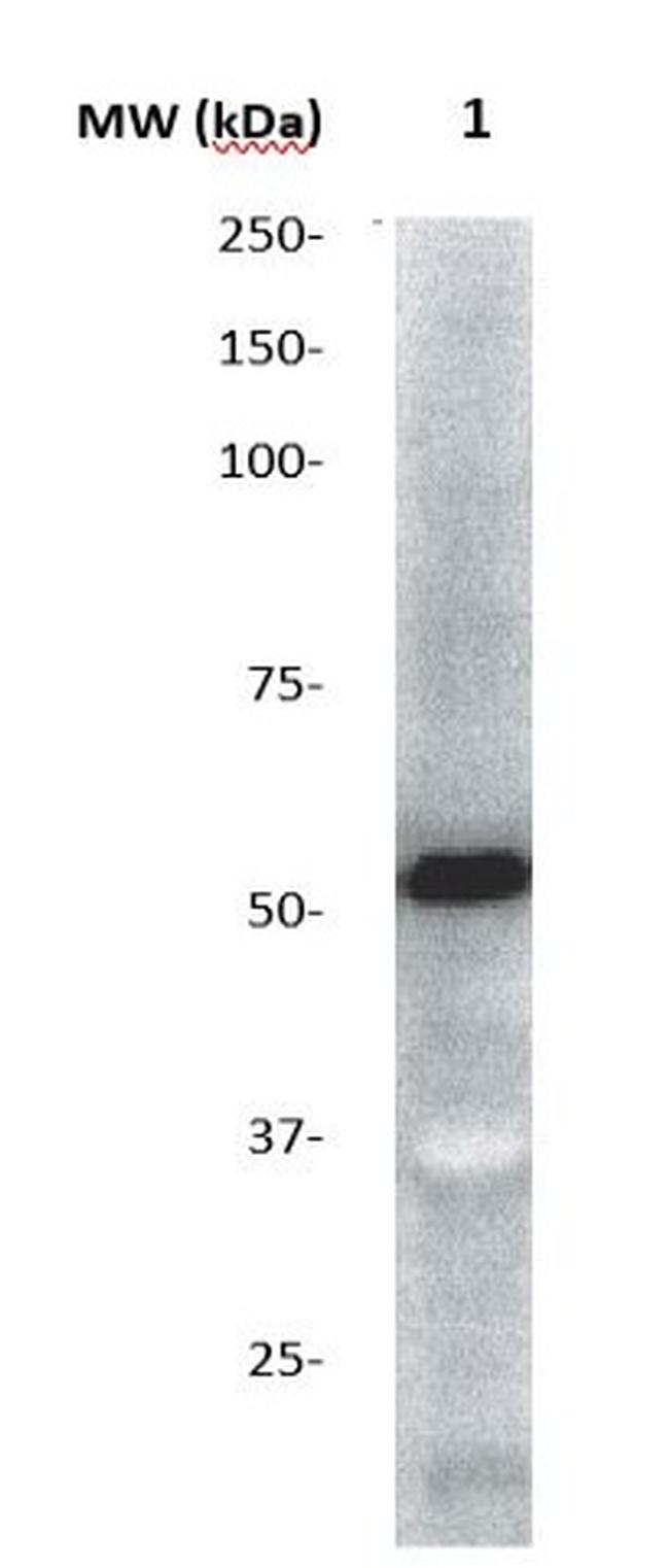 AKT2/PKBb Antibody in Western Blot (WB)