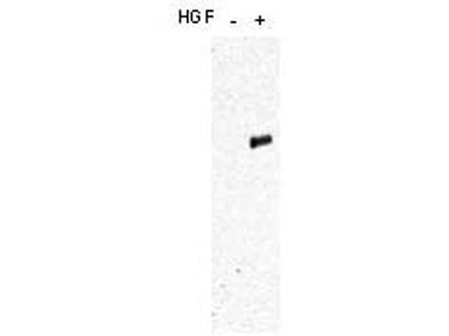 Phospho-c-Met (Tyr1349, Tyr1356) Antibody in Western Blot (WB)