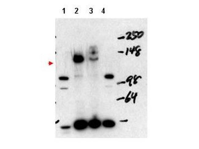 NCOA3 Antibody in Western Blot (WB)