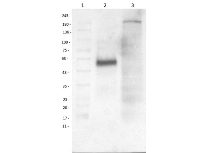 beta 1 Adrenergic Receptor Antibody in Western Blot (WB)