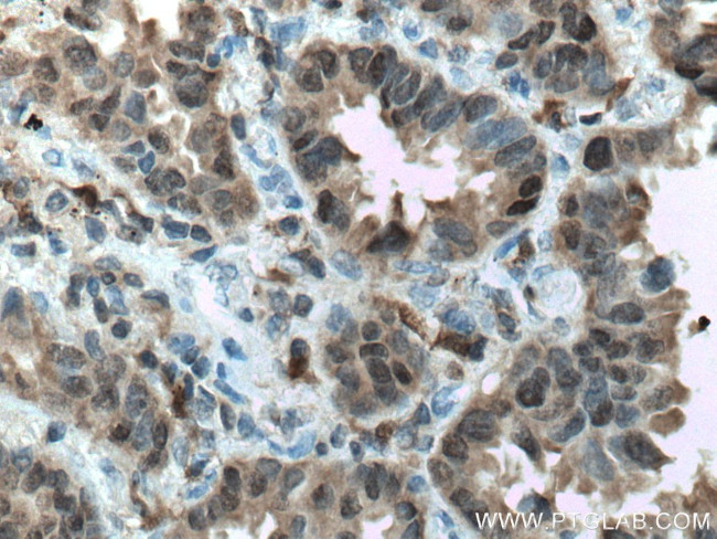 S100A11 Antibody in Immunohistochemistry (Paraffin) (IHC (P))