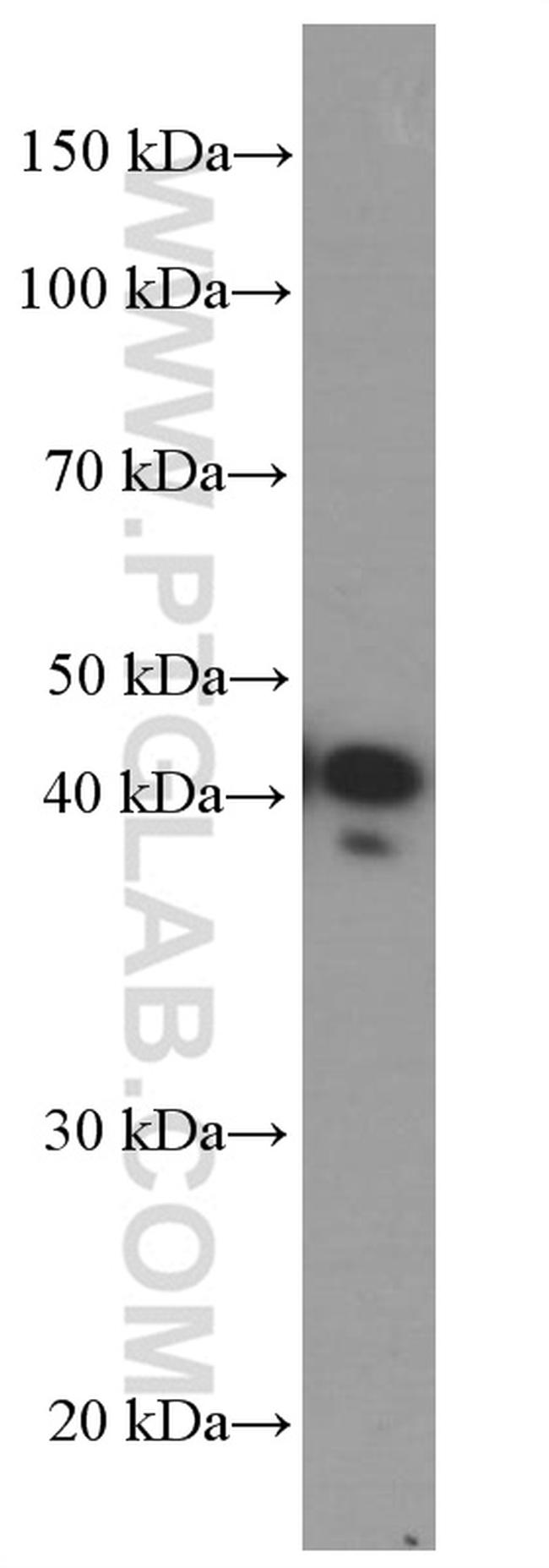 CXCR3B Antibody in Western Blot (WB)