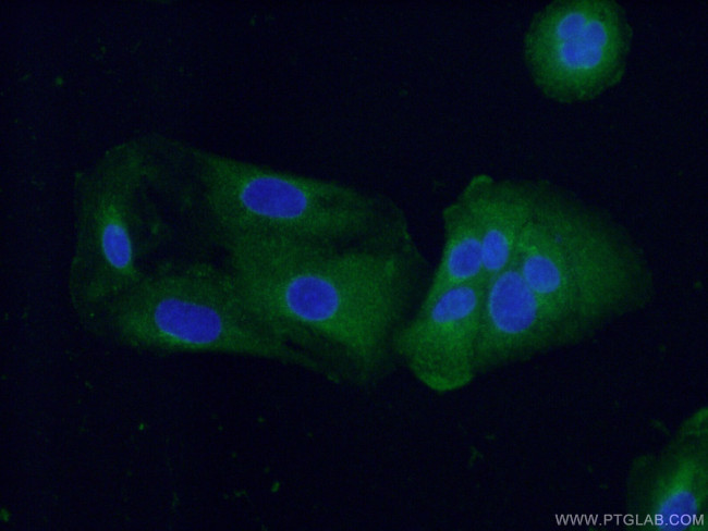 Fibulin 5 Antibody in Immunocytochemistry (ICC/IF)