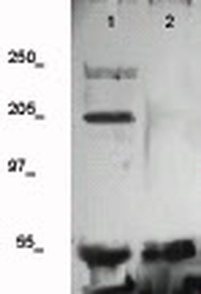 VEGFR-2 (CD309) Antibody in Western Blot (WB)
