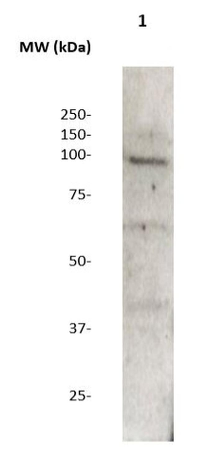 Androgen Receptor (AR) Antibody in Western Blot (WB)